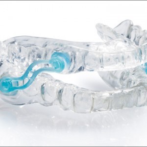 sleep apnea oral appliance dental device